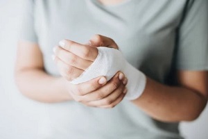 women with injured hand